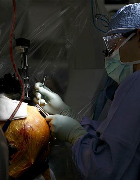 DBS surgical procedure A small incision is made in the