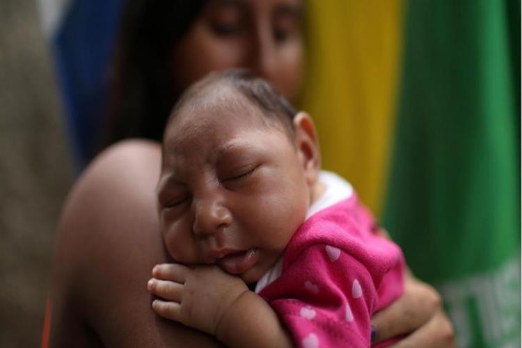 Congenital Zika Syndrome Mother with a history and lab evidence of Zika infection Infant with physical features: Microcephaly