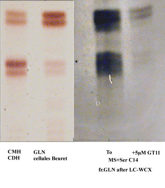 Autoradiography Glc-Cer Autoradiography of lipids from rat liver subcellular fractions incubated with UDP-[ 14 C]-glucose