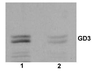 Extracted lipids from subcellular fractions (150 µg protein / incubation) were resolved by TLC using solvent system II on
