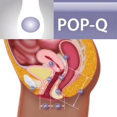 materials, the interactive POP-Q System Programme and reimbursement guidelines.
