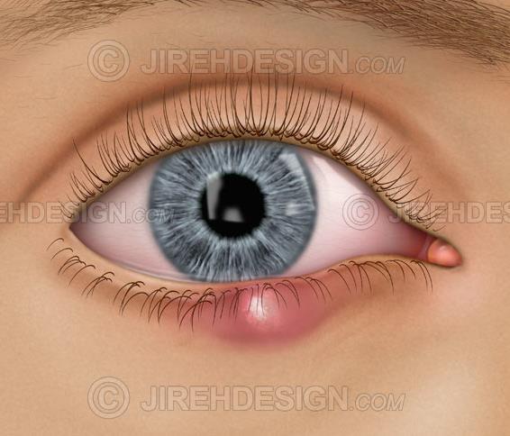 Eyelid anatomy