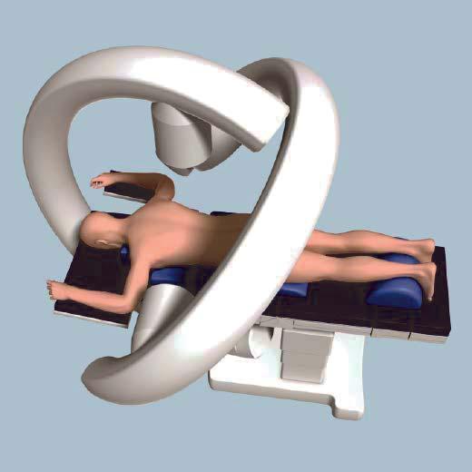 Biplanar fluoroscopy is recommended for the most efficient use of imaging. A single, freely mobile C-arm may also be used.