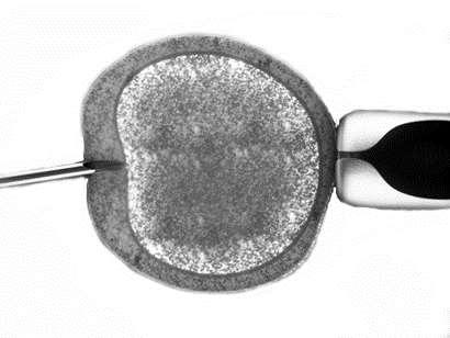 ICSI Process of injecting individual sperm into individual egg Good for: Male factor (poor sperm) Previous failure of