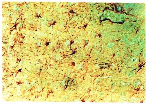 Types of Astrocytes Figure 2. Astrocytes seen as star shaped cells when stained with enzyme labeled antibodies against glial fibrillary acidic proteins (dfap).