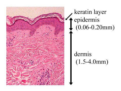 Figure 1 A typical cross section of human skin Chief coloring factors that relate to skin color are the melanin pigment in the epidermis and the blood hemoglobin in the superficial layer of the