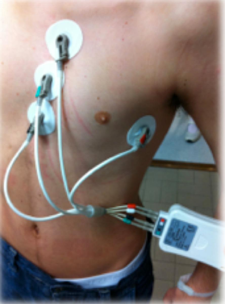 Fig. 1: Correct positioning of electrodes