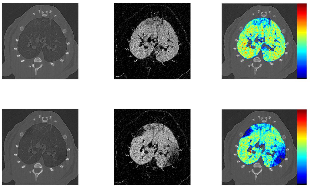 Spatial Resolution Best spatial resolution currently available for imaging regional lung function Baseline Tissue Xenon KES sv n 200 % sv mean 100 0 1cm Pixel: 47 µm; 1800