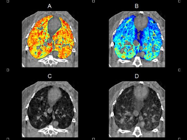 KES-CT of within-tidal changes in regional lung blood and