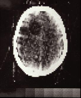 tomography 1975 1977 Nuclear Medecine 1869 1877 1895 1917 1935 Johan Radon publishes his Radon