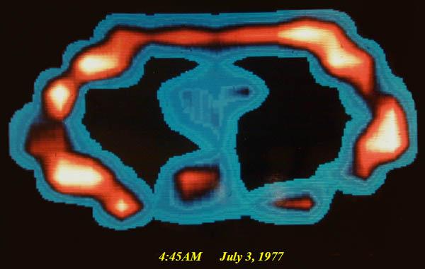 1980 s 2013 1 st µct 1 st Human Synchrotron CT X-ray Crooks tubes Cathode rays 1 st Synchrotron