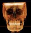 Cephalometric Studies Evaluate geometry of the face and make decisions