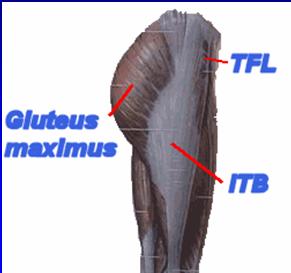 / flexion Abrupt motion of iliotibial tract or gluteus