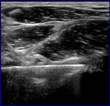 J. J Ultrasound Med 2009; 28:329 F Joint