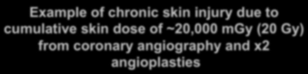 Example of chronic skin injury