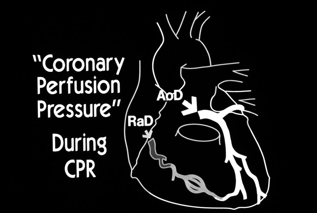 Coronary Perfusion Pressure Critically Important for Successful CPR CoPP >20 mmhg;