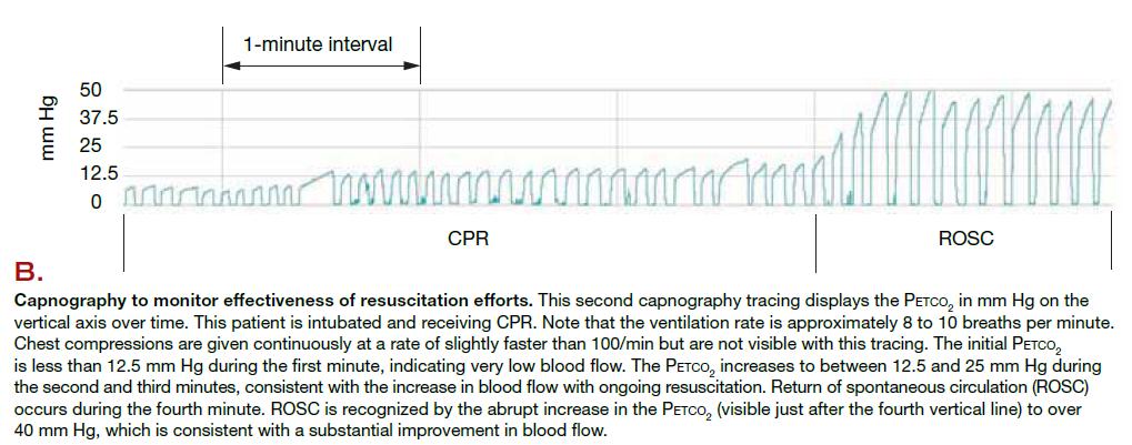 Waveform Capnography During CPR Neumar 1/21/17
