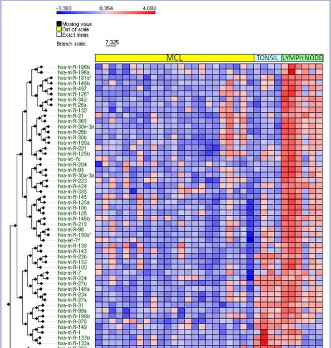 mirna expression in MCL Heat map of significant mirna