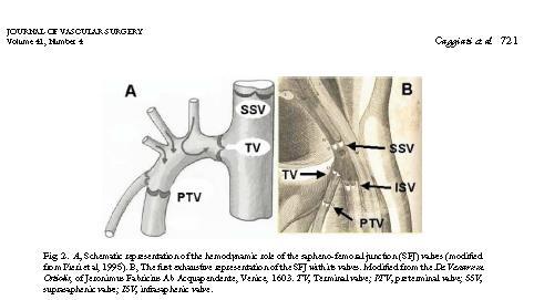 SFJ= saphenous junction SSV = suprasaphenous valve TV = terminal valve PTV = preterminal valve M.