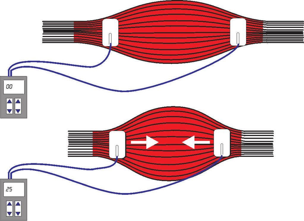 Electrical Muscle