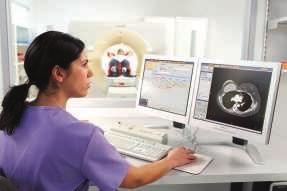 Answers in radiation oncology In radiation oncology, successful outcomes are measured by consistently and confidently moving patients into the right treatment plan.