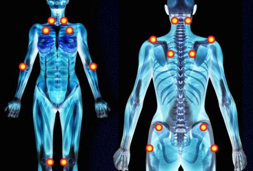 Fibromyalgia Symptoms The hallmark of fibromyalgia is muscle pain throughout the body, typically accompanied by: Fatigue Sleep problems Anxiety or depression