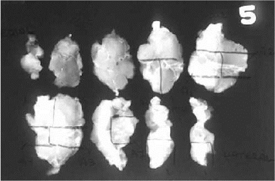 Figure 2: Specimen radiograph after margins were inked and serial sections were made.