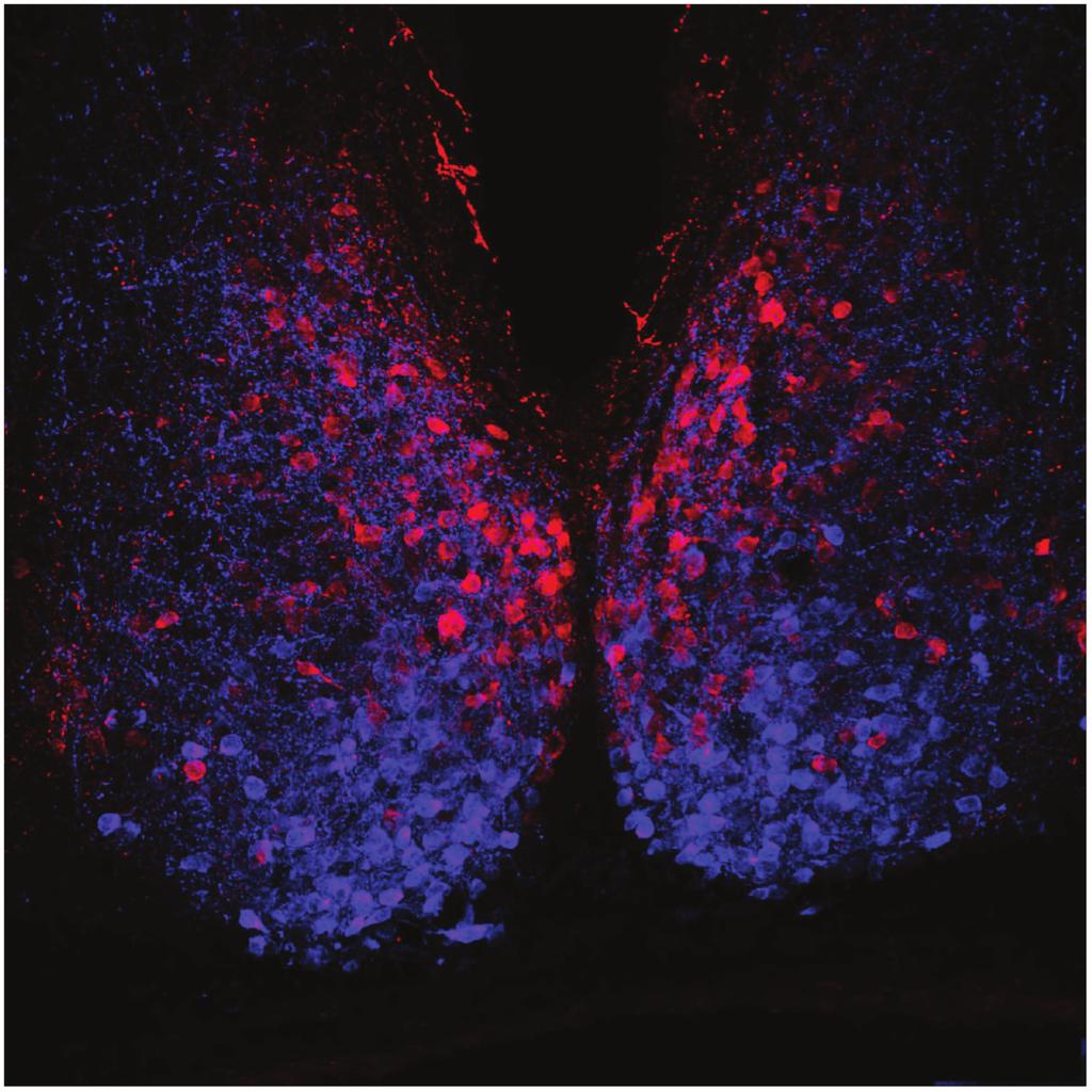 Neural Plasticity 3 0 휇m 75 Figure 1: Representative confocal microscopic image of neuropeptide expression in the mouse suprachiasmatic nucleus (SCN).