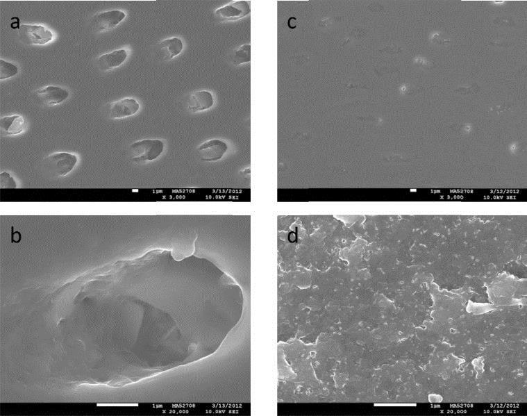 Remineralization of fluoride varnish Electron microscopic pictures in vitro Demineralized dentin
