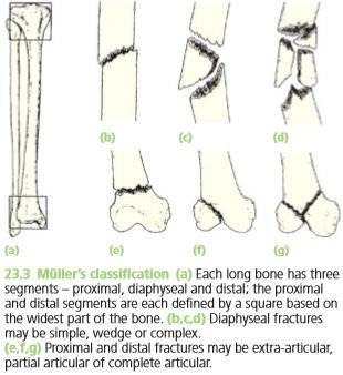 Slika 4.2. Müllerova klasifikacija prijeloma kosti; preuzeto iz: Solomon L et al. (2010), Apley's System of Orthopaedics and Fractures; str. 689.