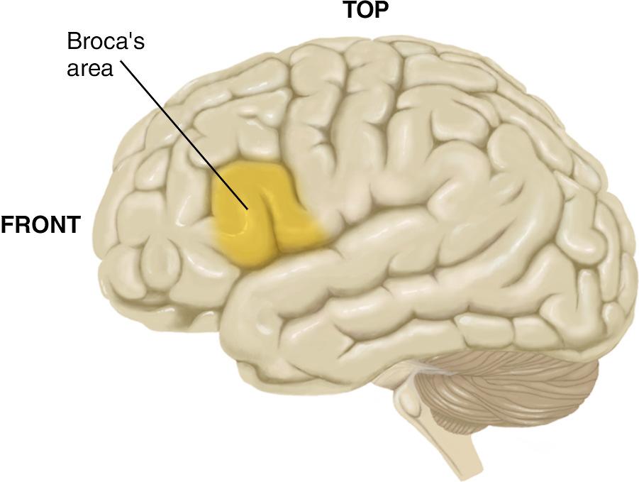 Broca s Area and Patient Tan Lateralization of Function For many functions the hemispheres do not differ and where there are