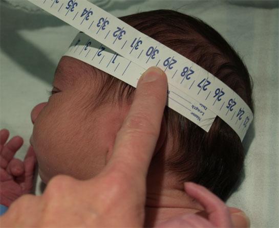 MEASUREMENT OF HEAD CIRCUMFERENCE (HC) HC should be measured using 