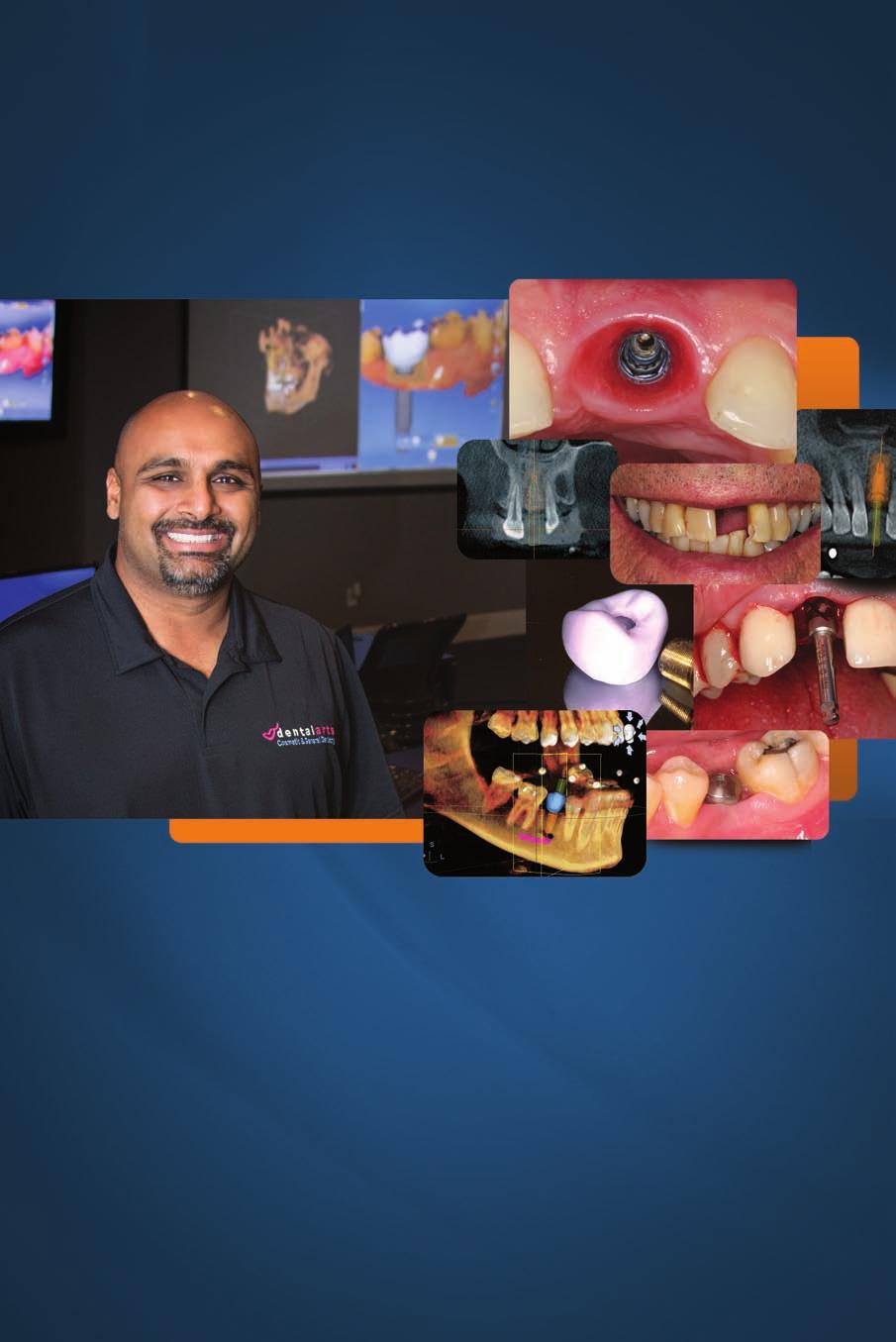 3D Mastery Dental Implants DIGITAL DENTISTRY