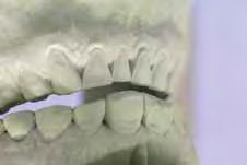 scheme and the pre-operative condition of the teeth.