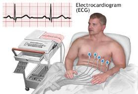 the Purkinje Fibers Entire musculature depolarizes quickly Electrocardiogram Variations in electrical potential radiate from the heart ECG records