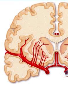 The middle cerebral artery (MCA): Runs laterally in the lateral fissure to the insula where it divides into terminal branches