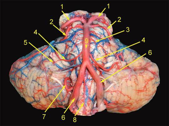 The posterior cerebral artery (PCA): Curves backwards around the midbrain & comes below the splenium of corpus callosum where it divides into branches which run in the calcrine & parieto-occipital