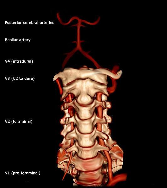 Vertebral arteries Arises from the 1 st part of the subclavian artey.