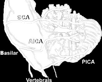 cerebellar artery (AICA) from basilar artery