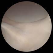 inspection of the shoulder joint Learn how to bring the probe to all relevant