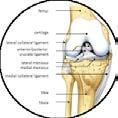 Didactic modules General concepts of arthroscopy Equipment
