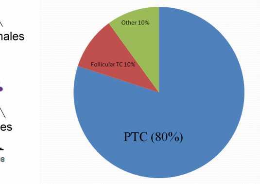Thyroid Cancer TC incidence rates in NSW Several subtypes - Papillary thyroid cancer (PTC) is the most prevalent Females