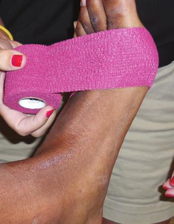 Ankle Compression Wrap Materials needed: Coban Self-Adhesive Wrap The ankle should be at about a 90-degree angle. 1. Start where the toes meet the body of the foot.