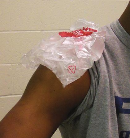 Ice Packs Materials needed: Ice bag, ice, exoclear or ace bandage 1.