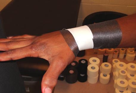 Wrist Taping Be sure circulation to taped extremity is checked before and after tape is applied.