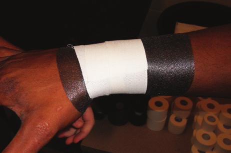 5 inch tape Basic Wrist Position athlete with palm facing down and fingers spread to assist in keeping proper
