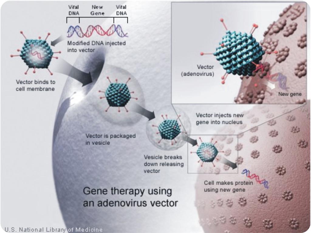 Using a Virus in Gene Therapy: A normal human gene is inserted into a virus. The virus carries the gene into a human host cell. The gene enters the nucleus and becomes part of the DNA.