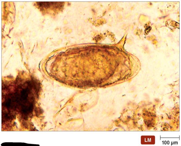 Blood Flukes: Schistosomes Schistosomiasis prominent parasitic disease Schistosoma mansoni, S. japonicum, S.