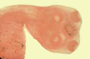 Flatworms Cestode (Tapeworm) Infestations Long, very thin, ribbonlike bodies composed of sacs (proglottids) and a scolex that grips the intestine Each proglottid is an independent