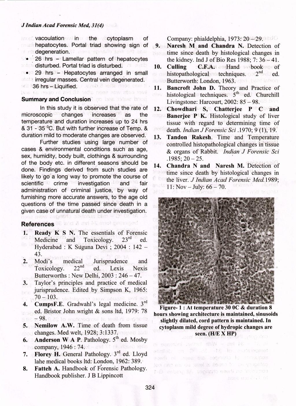 J'Indian Acad Forensic Med 31(4) vacoulatlon in the :cytoplasm of Company: phialdelphia 1973: 20-29 ' hepatocytes Portal' triad showing sign of \9 Naresh-M and Chandra N Detection of degeneration